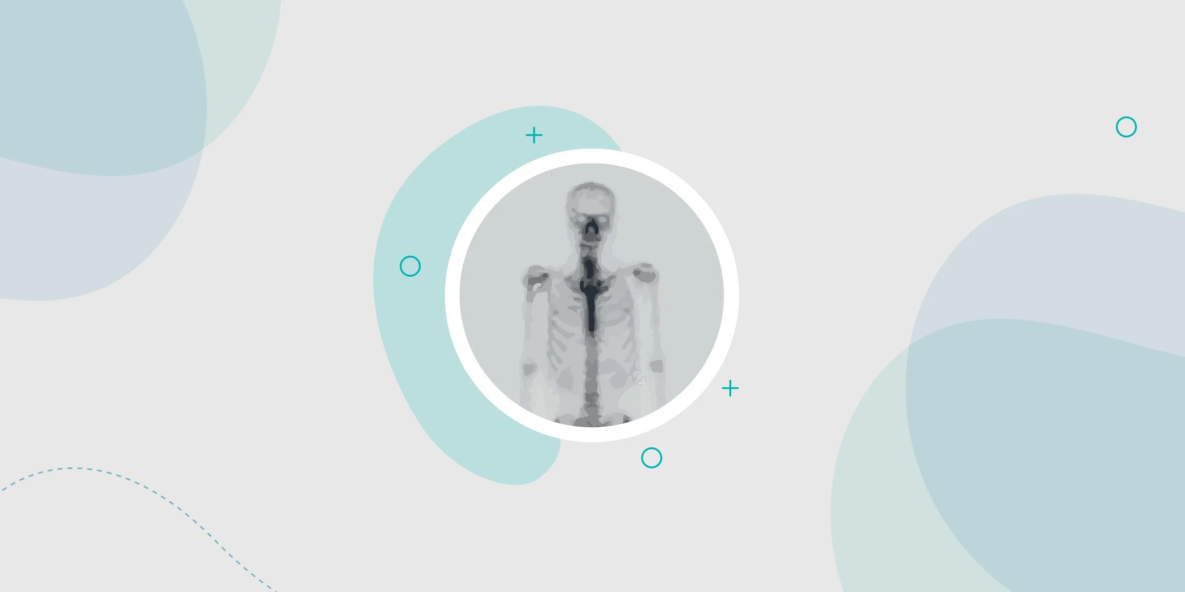 Bone Scan in orthopedics