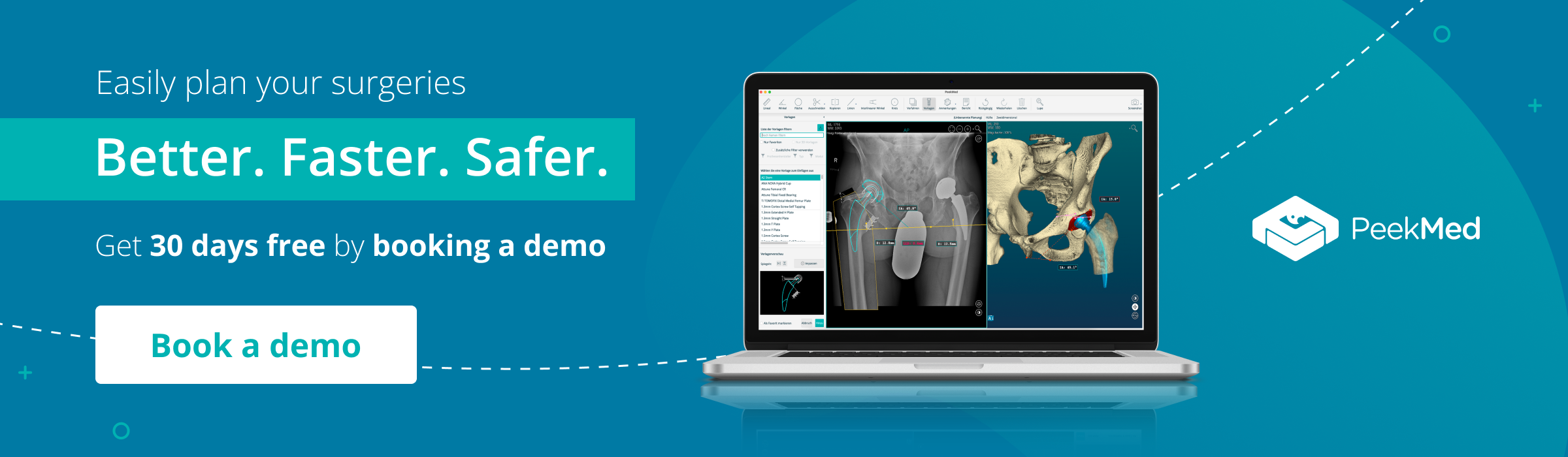 Free Preoperative Planning orthopedic