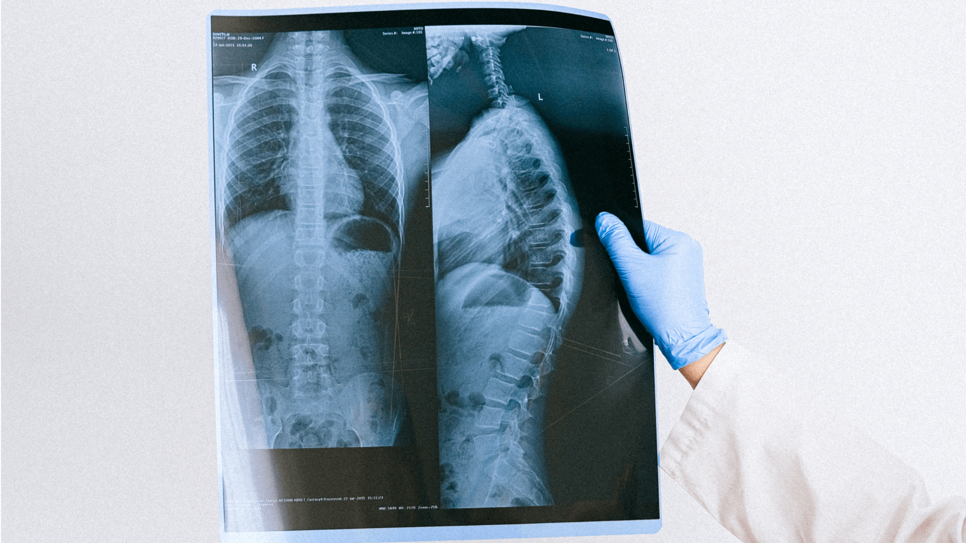 What are DICOM Images? Everything you need to know