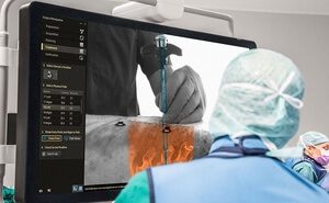 Virtual Reality orthopedics