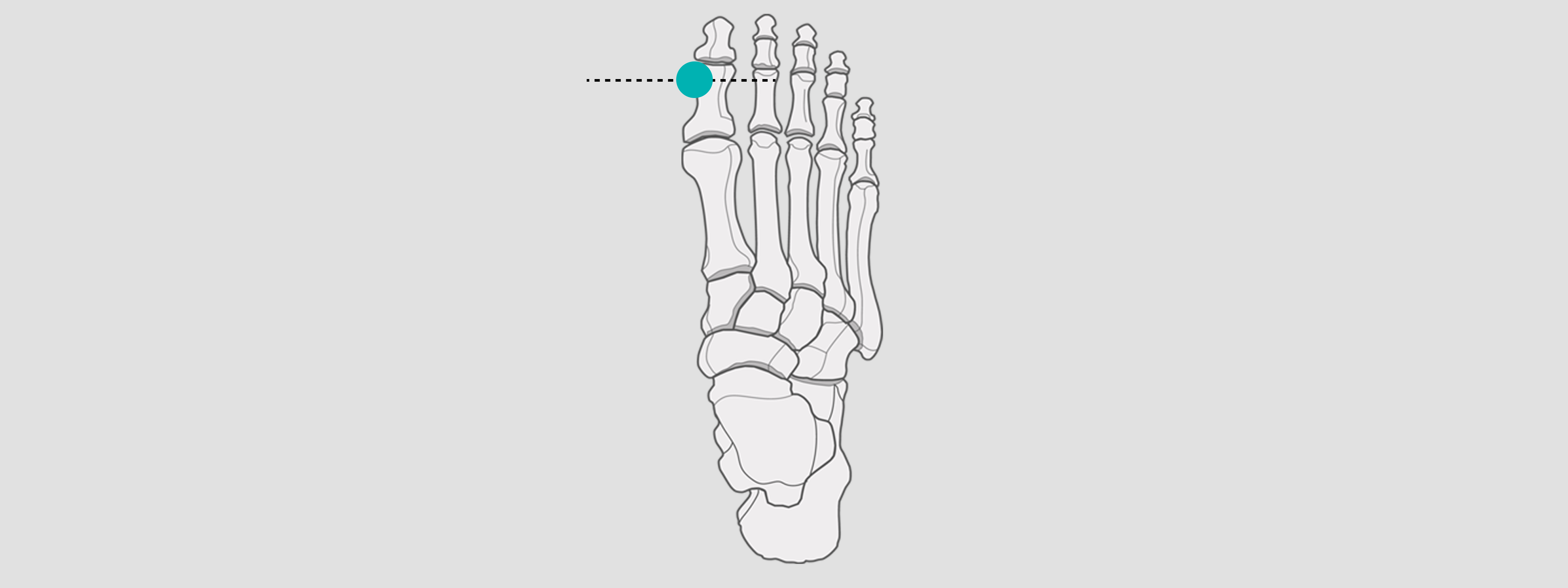 X-ray Calibration feet