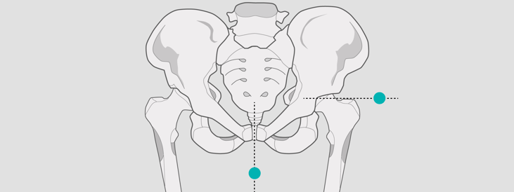 x-ray calibration hip