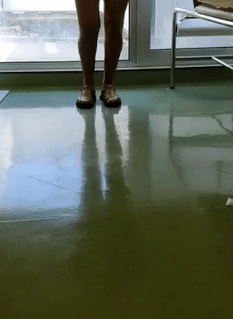 Patient Walking after Double knee surgery