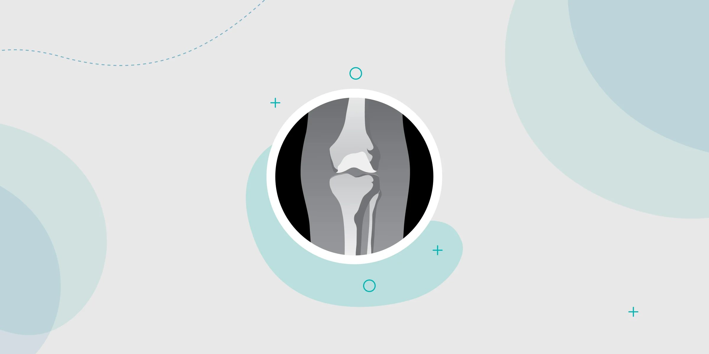 X-Ray in orthopedics