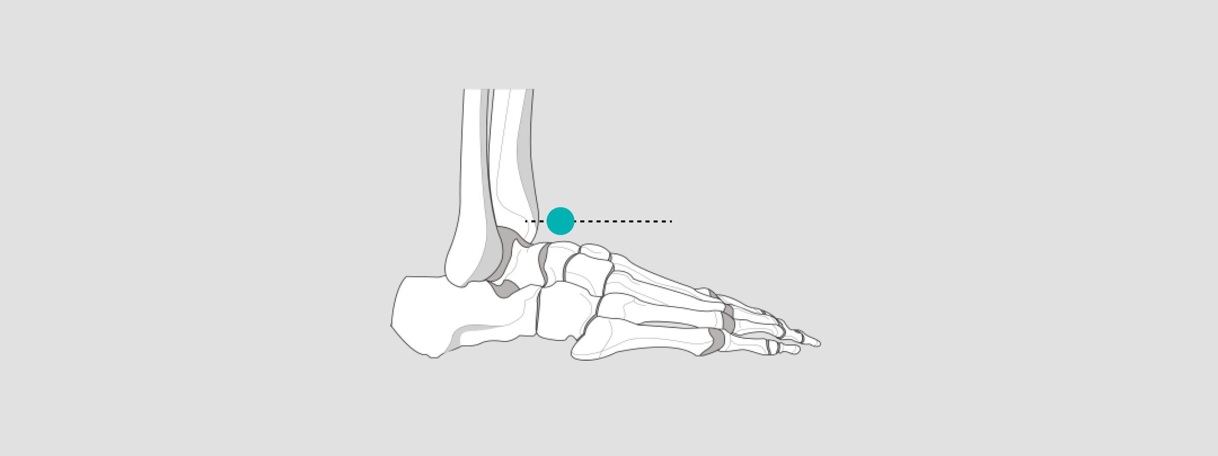 calibrate x-ray ankle