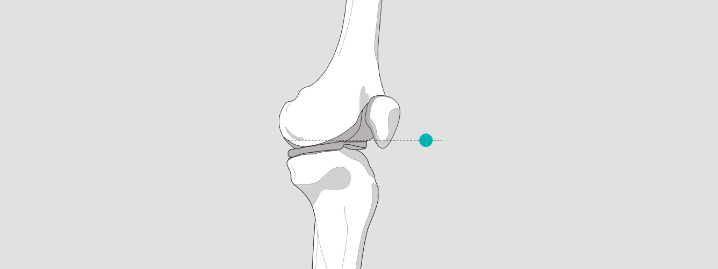 calibrate x-ray knee