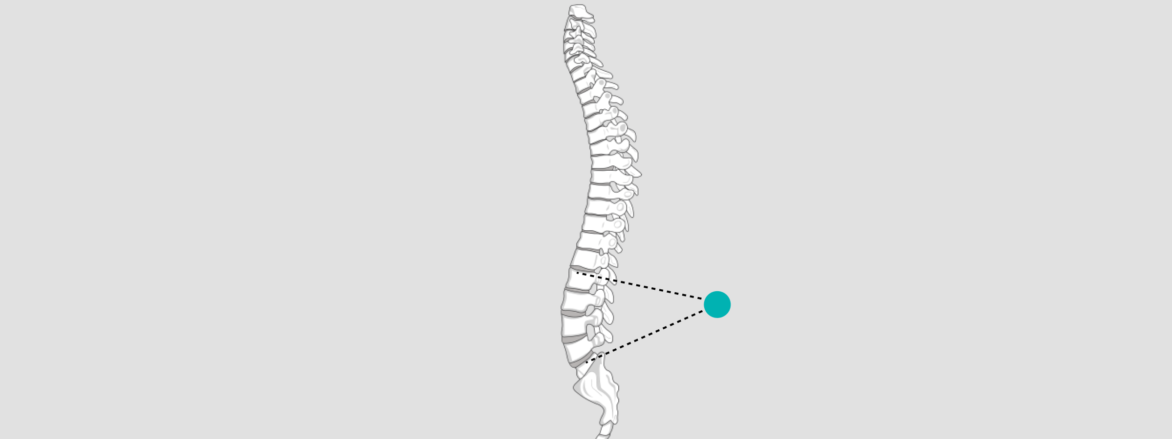calibrate x-ray spine
