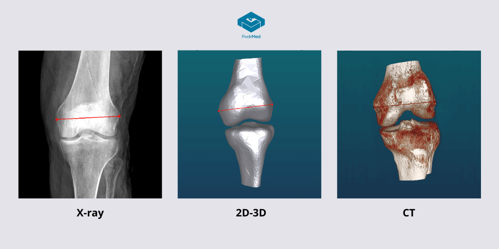 digital-measurements